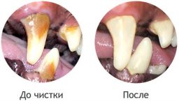 Чистка зубов у животных ультразвуковым аппаратом